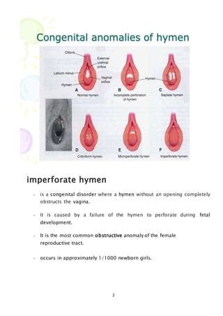 broken hymen|Hymen : Location, Pictures, Types, Repair Broken。